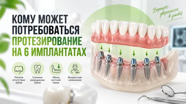 Картинка статьи